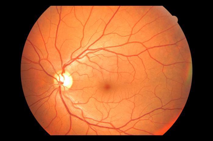 Eye part with rods and cones crossword