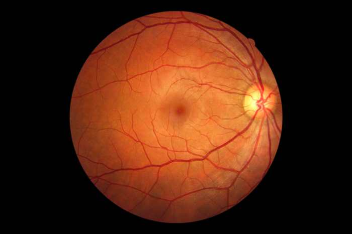 Macula vision